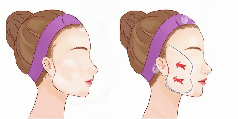 花19.9万做北京加减美V9值吗？整友8个月改善日记：价格对应结果太惊喜