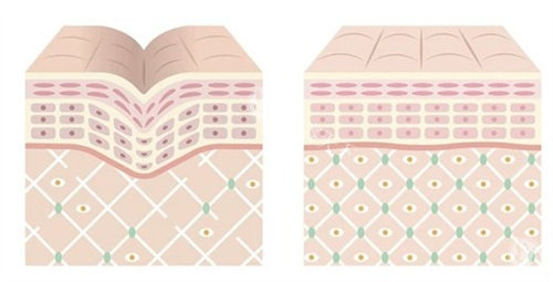 熊猫针注射原理