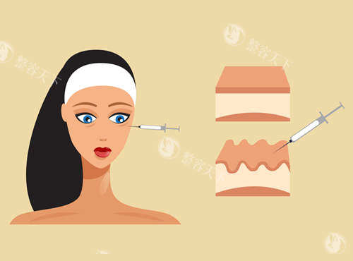 想了解王阔远医生面部减容收费标准吗？手术部位、填充物类型等影响价格全揭秘！