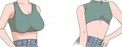 郑州缩胸手术医生推荐赵绛波，30年经验切口隐蔽形态自然！