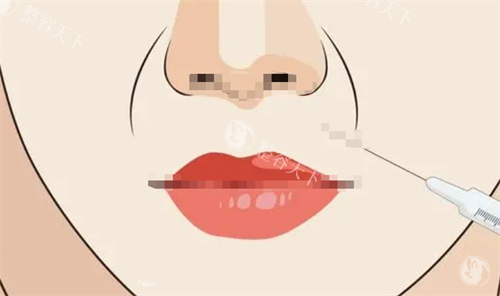 法令纹注射动画展示