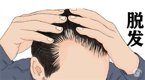 西昌恒美植发技术实测:微针种植真的无痕吗?地址在胜利南路一段238号