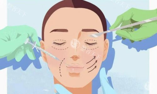 上海双眼皮医生推荐胡小清/佀同帅/杜园园，技术、风格、价格、实例全解析，附医院地址+预约技巧