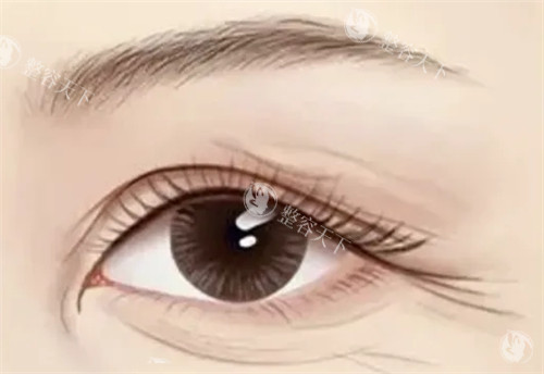 需要提眉切眉的情况