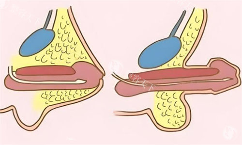 九龙医院男科预约全攻略：电话/官网/到院，私密整形手术一步到位！