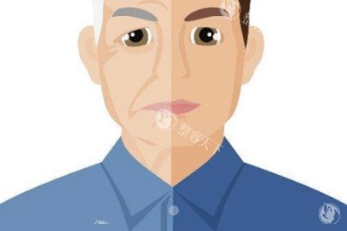 面部衰老提升卡通对比图