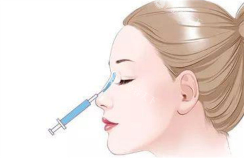 微晶瓷注射隆鼻过程