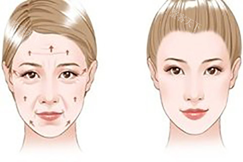 莫娜丽莎玻尿酸市场价大揭秘：700元是陷阱还是馅饼？避开低价陷阱看这里！