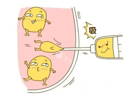 深圳八大处黄奔医生吸脂大揭秘！分层技术 + 真实实例，重塑理想身形！