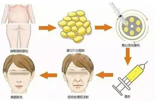 面部填充步骤图