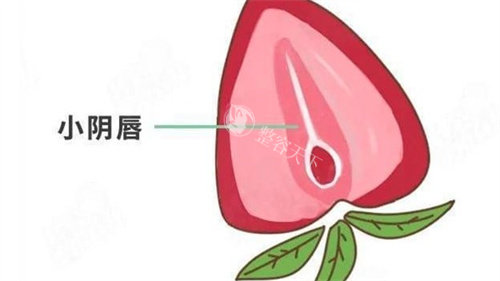 小阴唇整形