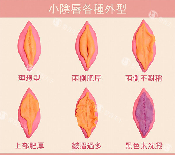 不同女性私密阴唇照片