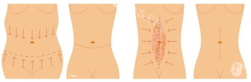 三亚整形医院哪家口碑好？本地人常去的3家机构，医生资质+术例分享！