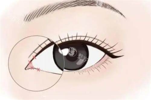 南通初颜医疗美容医院怎么样？技术靠谱，资质也很正规！