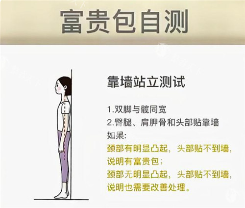 富贵包枕啤酒瓶能改善？医生亲授正确消除方法，别再乱试偏方了！