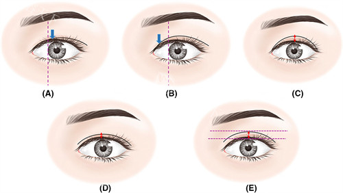 北京嘉美臻品医疗美容门诊部口碑超扎实！患者反馈“结果超出预期”，技术硬认可度高
