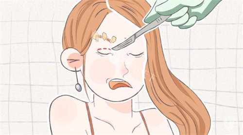 林靖双眼皮松单手术怎么样？20年专注眼部整形！双眼皮松单3D动态眼修复术疤痕隐形，状态稳定！