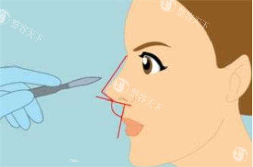 鼻部角度展示图图