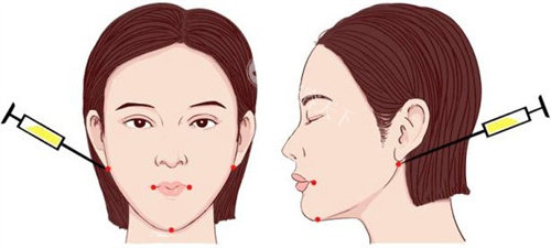 韩国皮肤科预约指南！官微、NAVER、翻译地陪，三种方式轻松搞定！