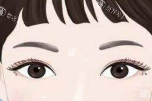 全切双眼皮卡通图一览