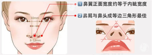 鼻翼缩小鼻翼图