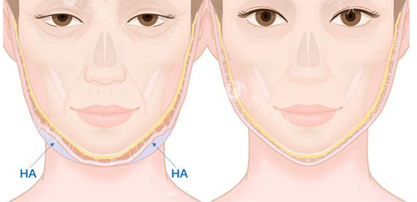 上海吴贞跃馒化脸修复可靠吗？资质合规+真实实例+整友好评印证可靠性