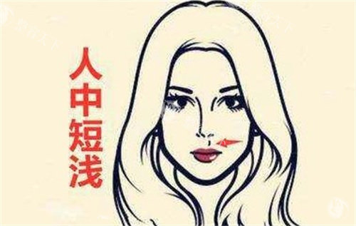 深圳福雅胡俊杰人中缩短有黑料吗？从过往术例、整友评价及技术细节来看没黑料