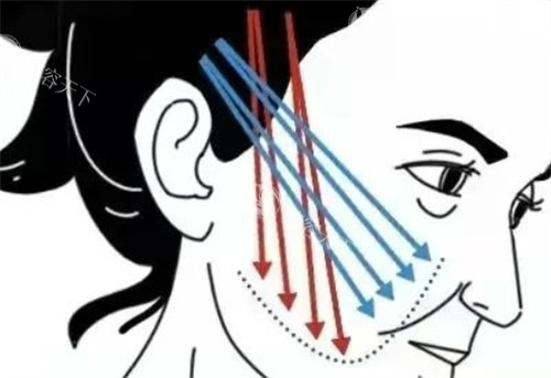 疑惑王易彬面部提升成效？深入剖析其独特技术与众多成功实例给你答案！