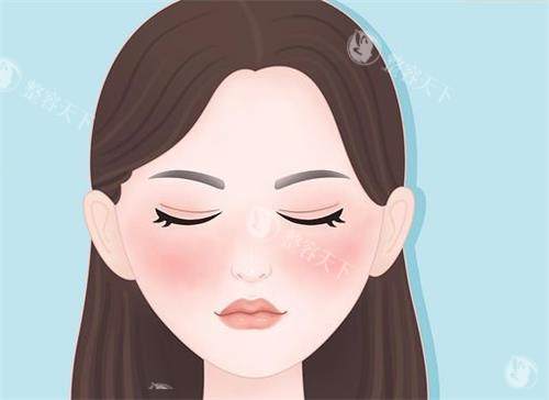 红血丝的卡通示意图