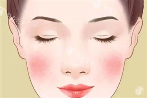 激光去红血丝卡通