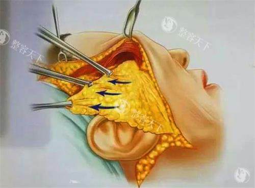 一文读懂黄寅守V美减龄术：25岁/45岁/60岁该选V3/V6还是V9？