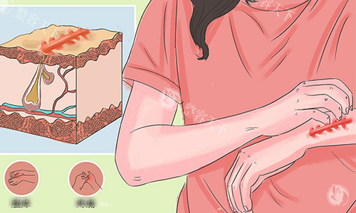 2026疤痕整形价格揭秘：激光/手术/注射收费不同？各类型疤痕报价全公开