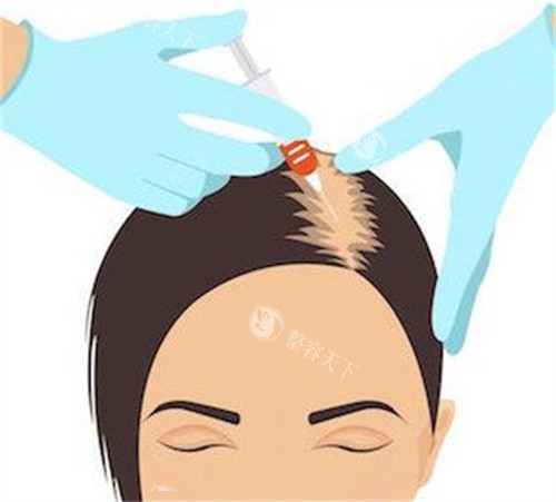 厦门植发哪家技术稳?思明区国贸大厦旁新禾曙光植发,微针技术+15年医生亲操！