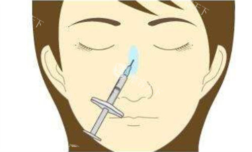 徐乃杰医生做隆鼻整形好吗？20年专注鼻部，术后都很自然立体！