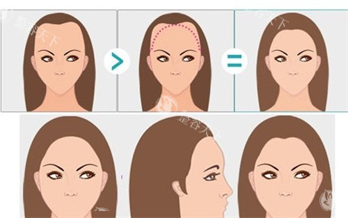 苏州植发正规医院排行发布！亚植植发/丽荣/维密植发/康美/维多利亚美容都在口碑榜单内~