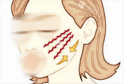 穆宝安面部提升技术如何？深耕抗衰40余年，V美减龄技术获行业认证，超万例临床实例见证，术后紧致可达十年