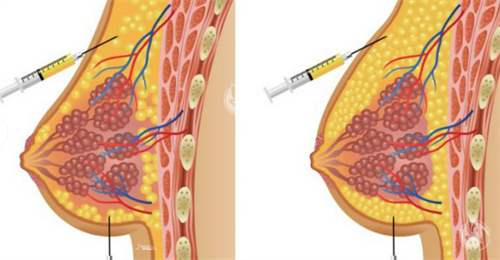 衡阳晶肤医美怎么样？正规资质+技术团队|光子嫩肤/脱毛口碑爆棚