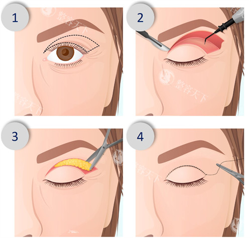 杭州壹美集医疗美容超棒！个性化方案适配需求，术后护理细，满意度高