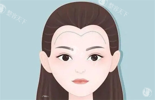 重森植发怎么样是正规医院吗，资质正规/技术成熟靠谱/是出色植发医院！