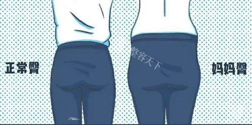 正常臀部和妈妈臀对比动画图