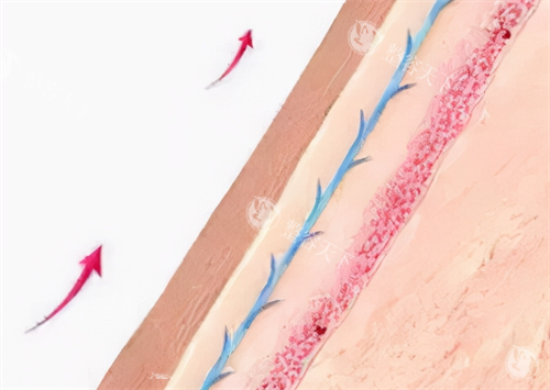 蛋白线提升维持时间揭秘！通常1-3 年，影响因素+延长技巧全解析