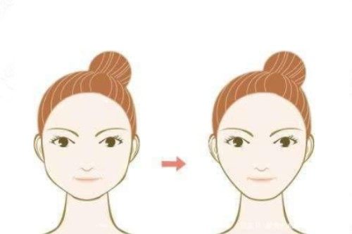 下颌角整形卡通前后对比图