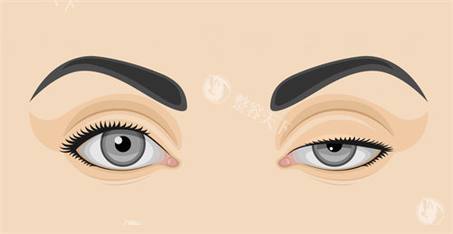 河北邢台臻悦整形怎么样？正规有实力！做眼综合和幼态脸打造评价好