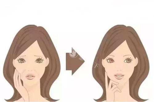 面部注射卡通对比图