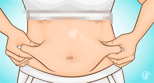 吸脂手术腹部脂肪堆积