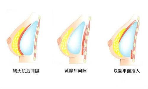 徐乃杰隆胸在武汉的口碑和评价公开，来看看徐乃杰擅长项目及整友反馈！