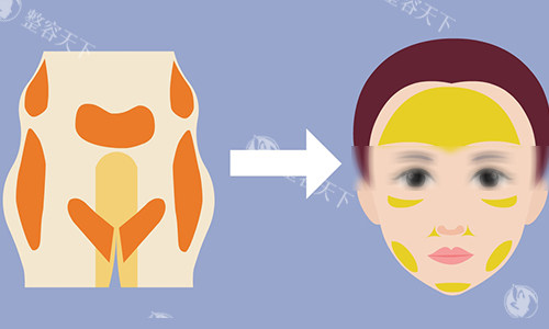 脂肪填充动画图