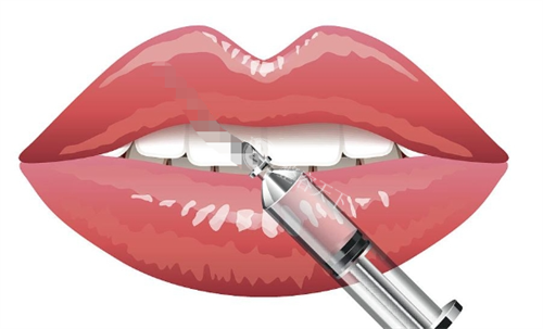 玻尿酸注射嘴巴动画展示