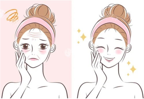 抗衰管理前后的对比图片