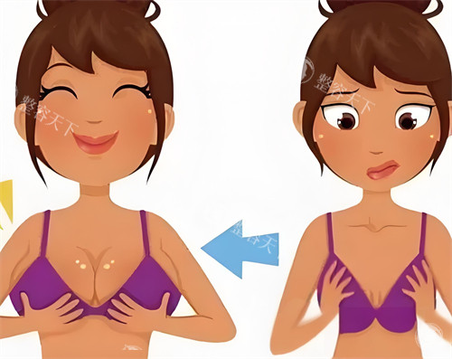 揭秘林沸腾医生隆胸秘诀：内窥镜超声提拉辅助，3 - 10 万打造专属美胸！